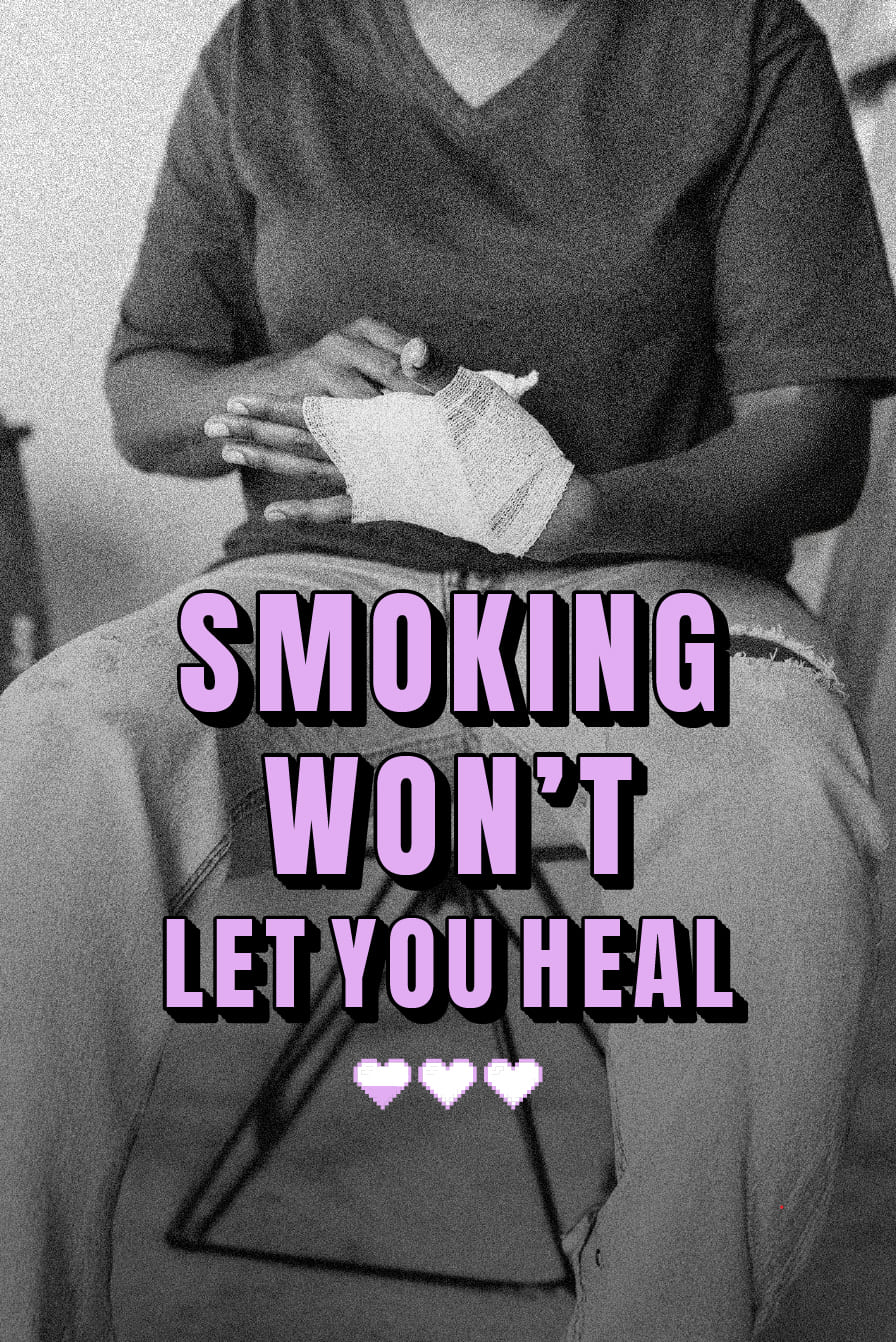 Smoking slows down wound healing.